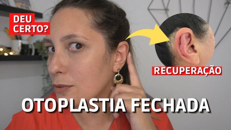 Descubra o Pre&ccedil;o da Otoplastia em Portugal: Guia Completo