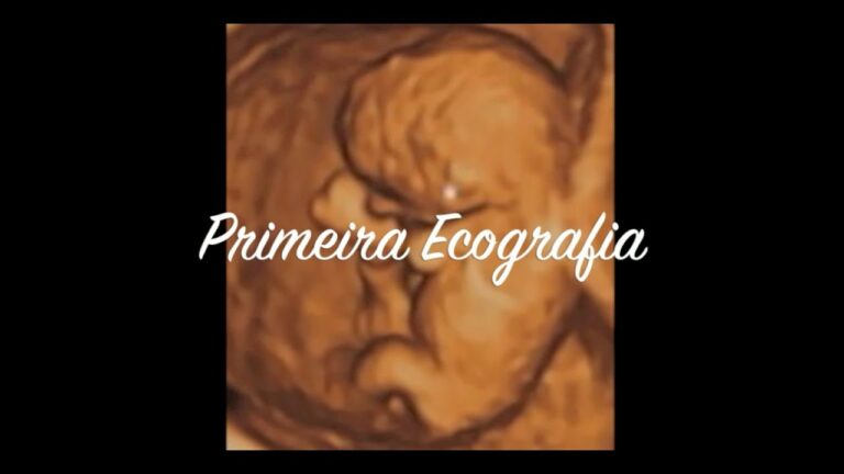 Ecografia de 3 meses: O que esperar e como se preparar