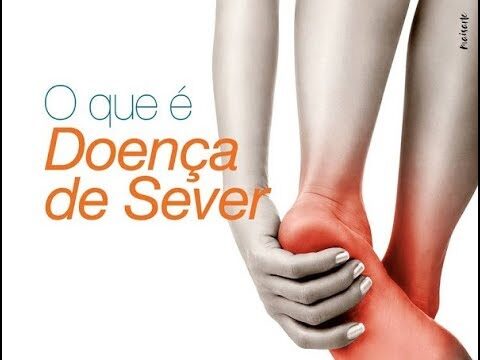 Doen&ccedil;a Severa: Otimizando o Tratamento para uma Recupera&ccedil;&atilde;o R&aacute;pida