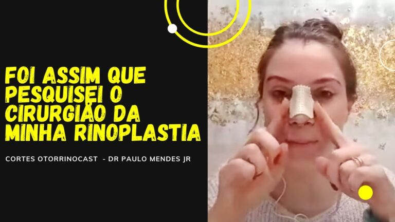 Melhor Cirurgião de Rinoplastia em Portugal