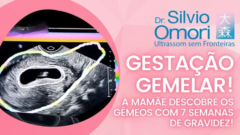 A fase inicial da gestação de gêmeos: 7 semanas de gravidez