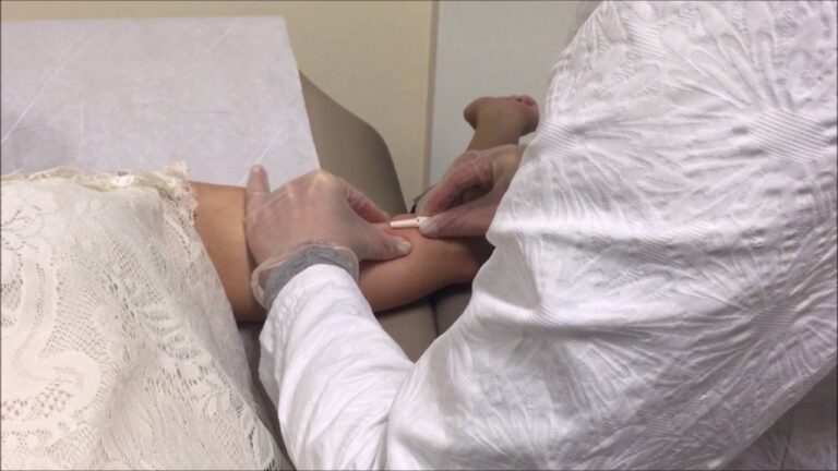 Implante Contraceptivo: Preço e Eficiência