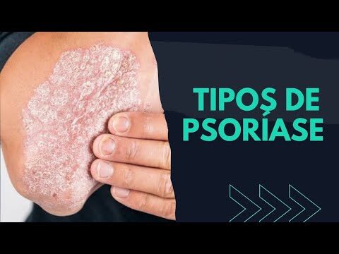 Dr. Pedro Ponte: O Dermatologista de Confian&ccedil;a